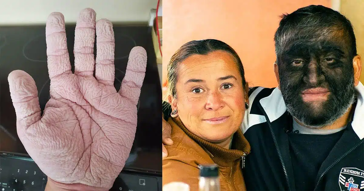 50 Pictures of unusual individuals demonstrate that genetic makeup is difficult to ignore.