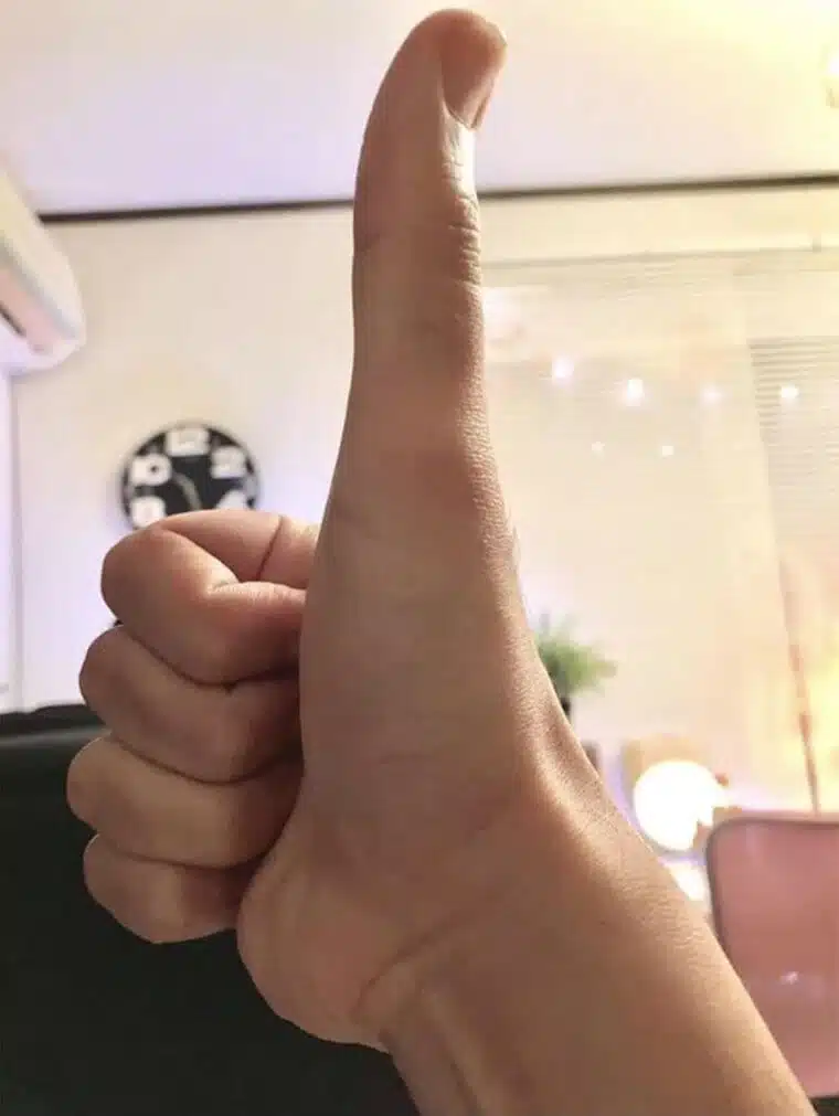 He's Never Lost a Thumb Battle
