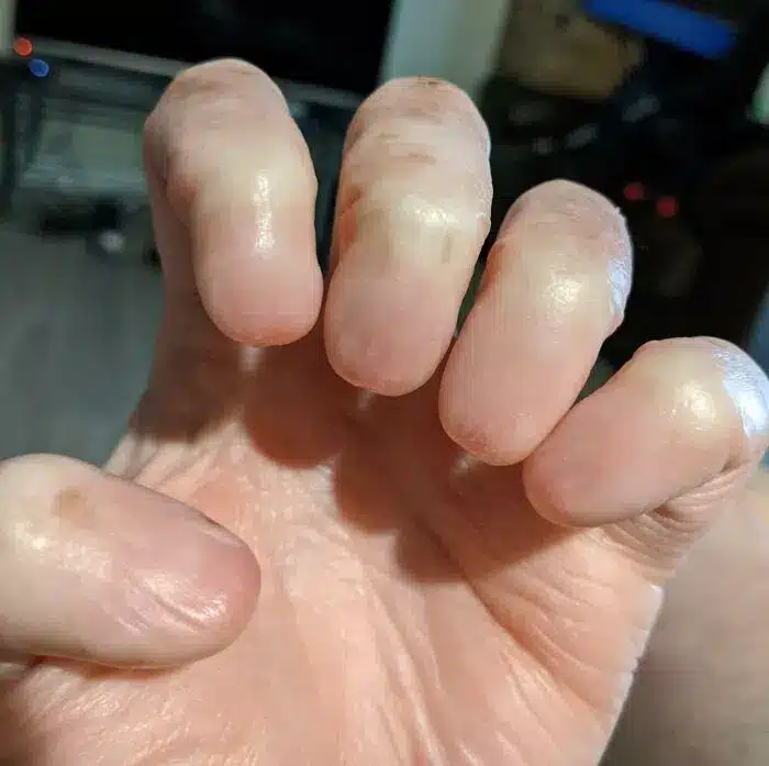 No Fingernails